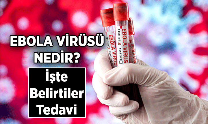 Ebola virüsü hakkında bilgi veren haber görseli