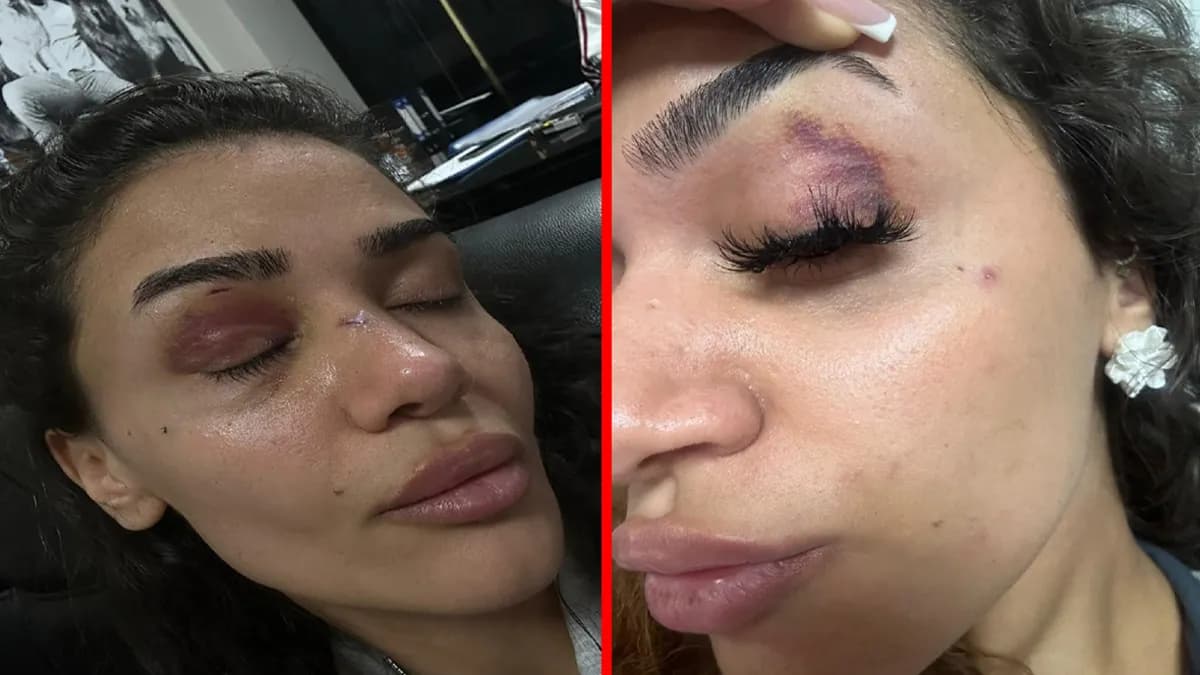Ebru Anik 'Beni şantajla zorla yanında tuttu' dedi: Uzaklaştırma kararına rağmen saldırı nerede ve ne zaman yaşandı?